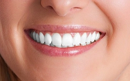 Implants Dentistry- Pure Smile Dental Group
